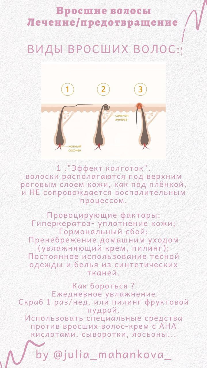 VIjYQDrDoxQ