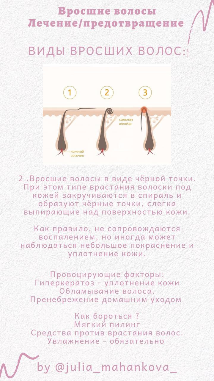YSB45rhMP9c